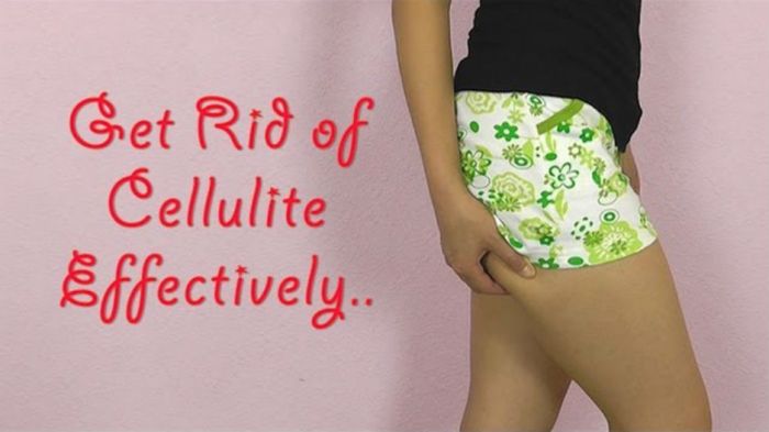 Get Rid of Butt and Thigh Cellulite
